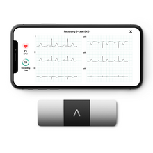AliveCor KardiaMobile 6L ECG