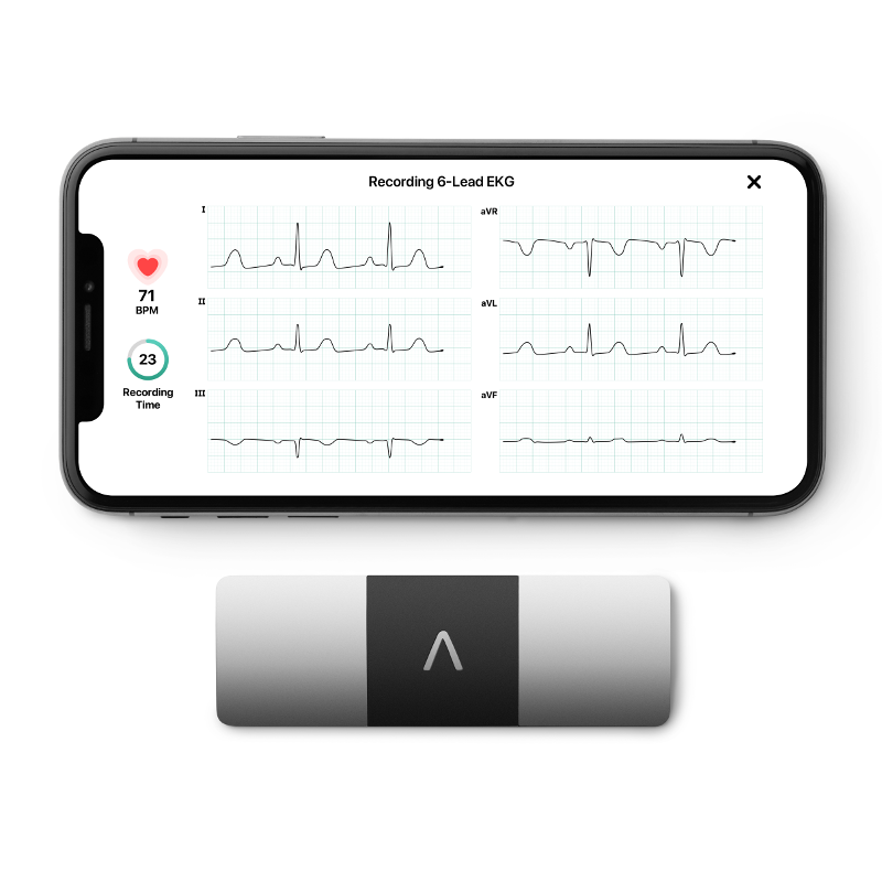 AliveCor KardiaMobile 6L ECG