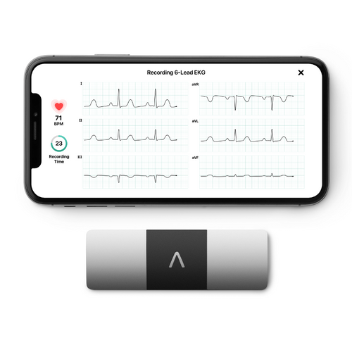 AliveCor KardiaMobile 6L ECG for iPhone and Android Free Express Post